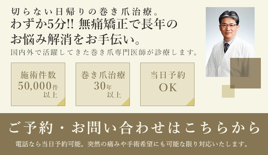 切らない日帰りの巻き爪治療