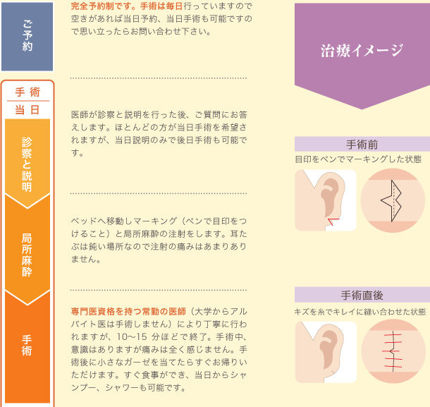 ご予約、診察と説明、局所麻酔、手術