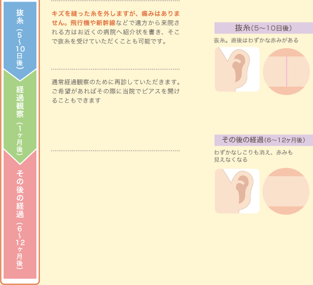 抜糸、経過観察、その後の経過