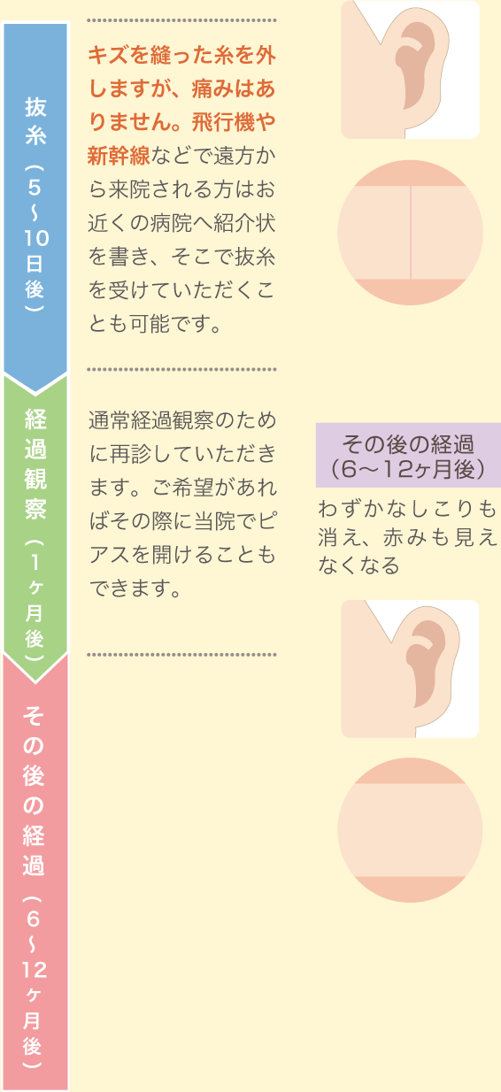 抜糸、経過観察、その後の経過