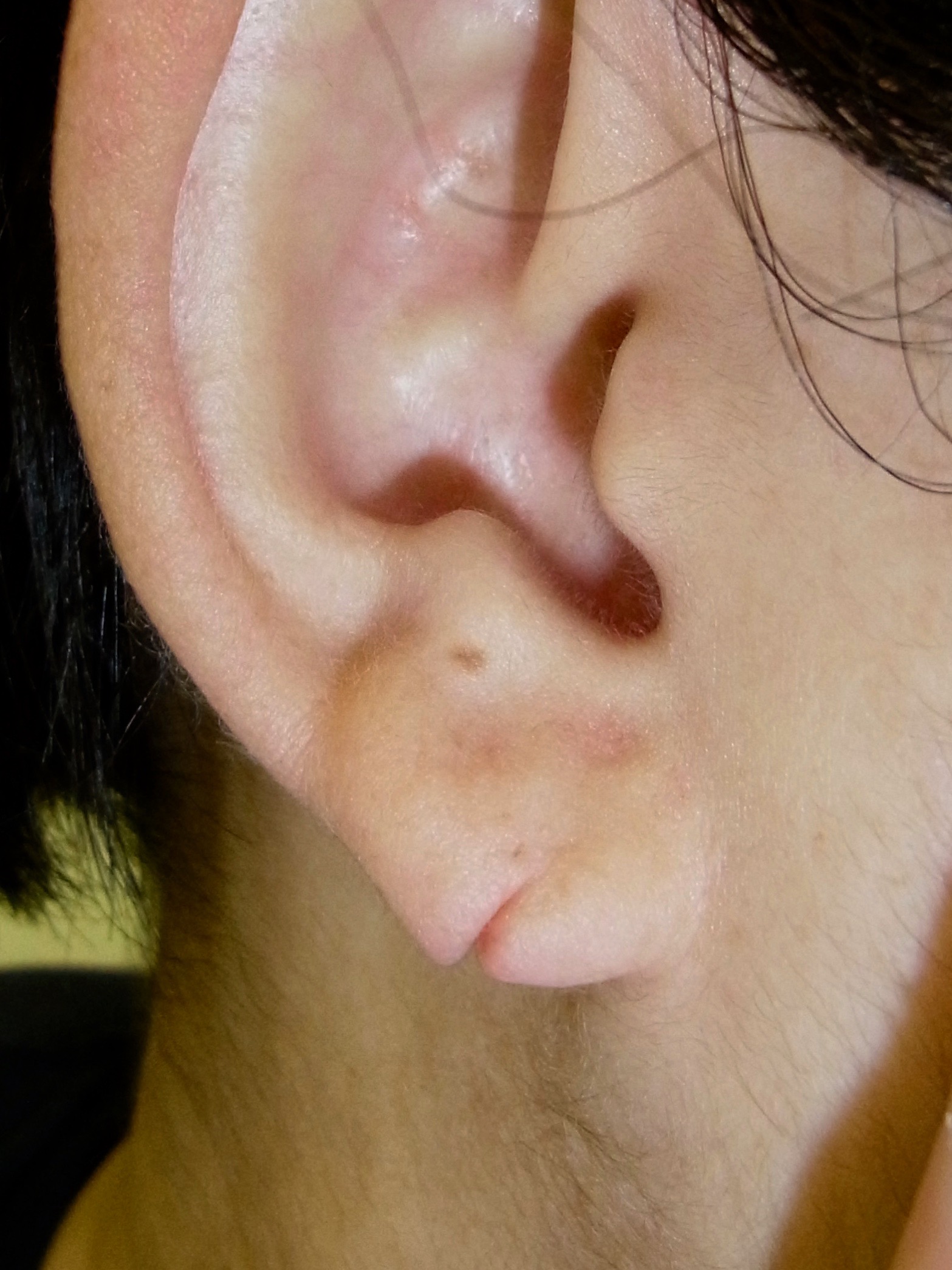 图2—6 耳廓的形态-眼耳鼻咽喉科临床解剖学-医学