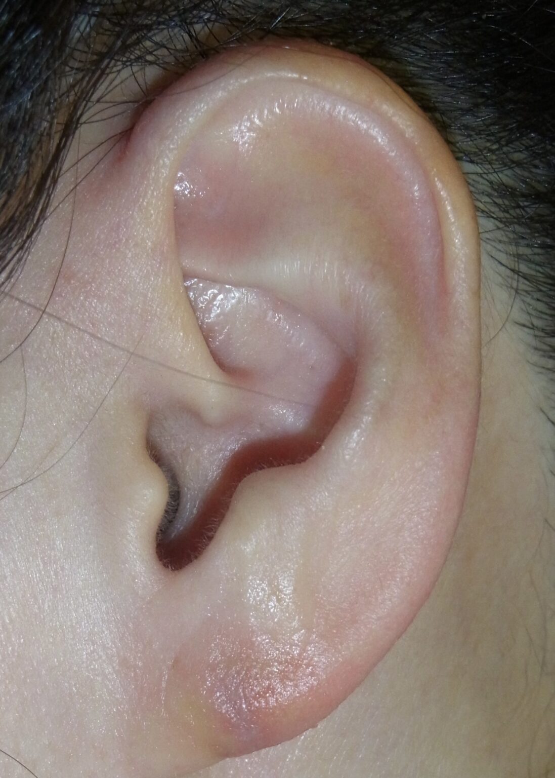 图2—6 耳廓的形态-眼耳鼻咽喉科临床解剖学-医学