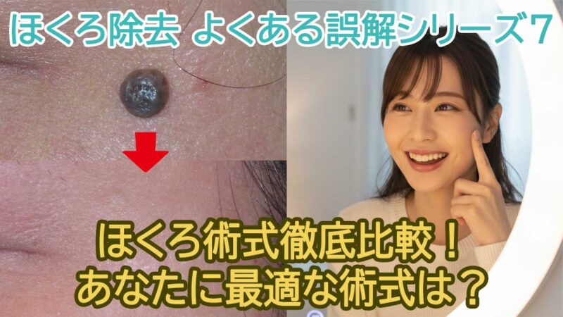 ほくろ術式徹底比較！あなたに最適な術式は？【ほくろ除去の誤解