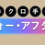 頬のホクロ手術・ビフォーアフター集5選
